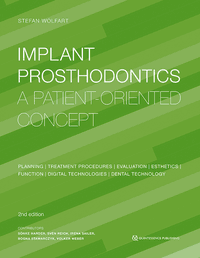 Implant Prosthodontics