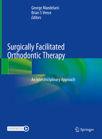 Surgically Facilitated Orthodontic Therapy