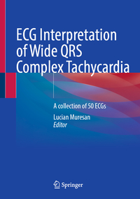 ECG Interpretation of Wide QRS Complex Tachycardia 