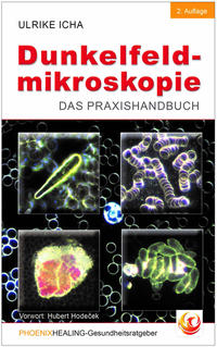 Dunkelfeldmikroskopie