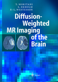 Diffusion-Weighted MR Imaging of the Brain
