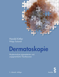 Dermatoskopie