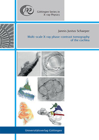 Multi-scale X-ray phase-contrast tomography of the cochlea