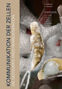 Die gesteuerte Knochenregeneration