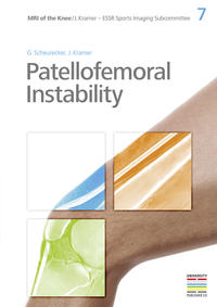 7. Patellofemoral Instability